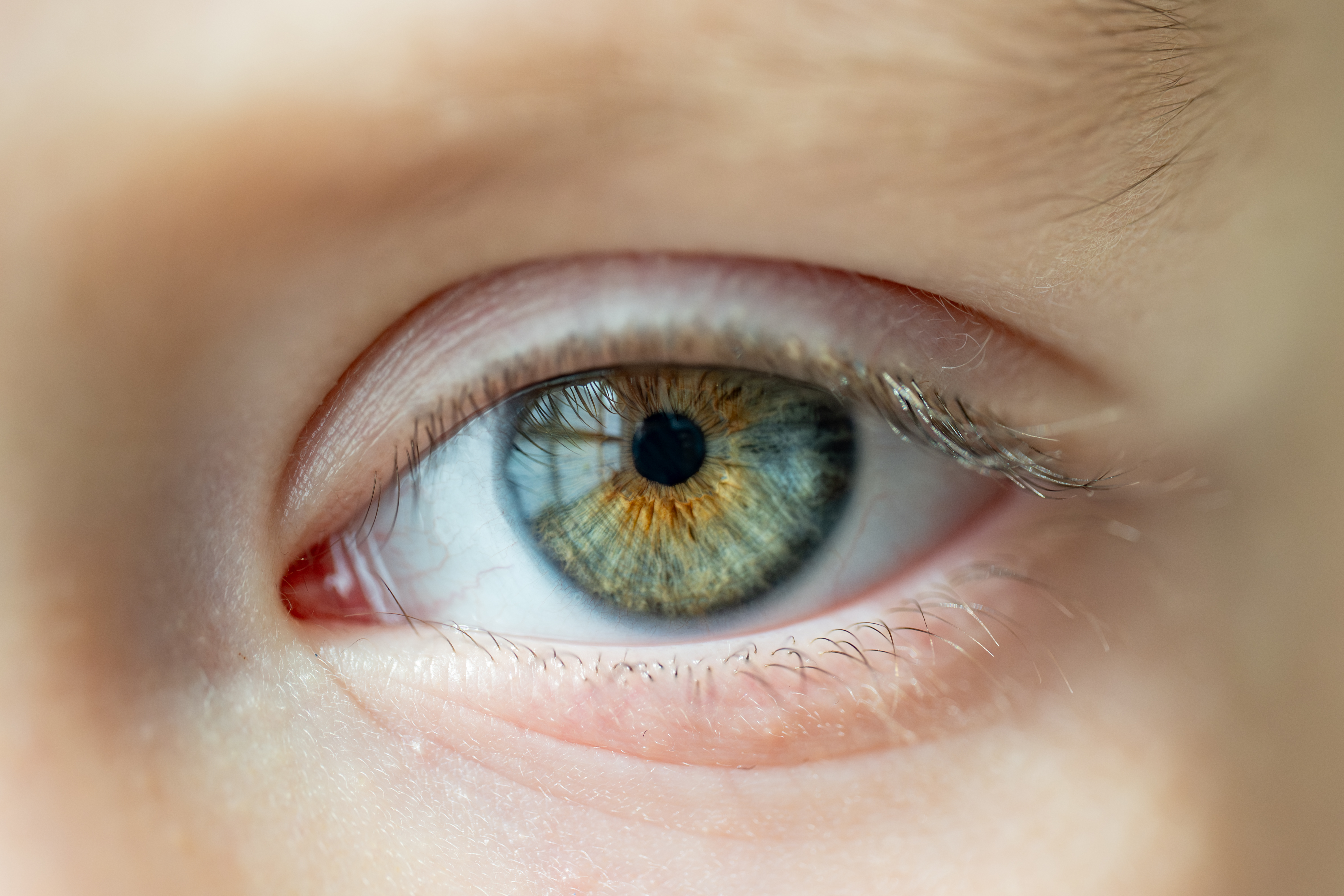 Prise de photo de l’iris avec un téléphone